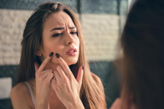 Acne  Acne Scar & Spot Treatments